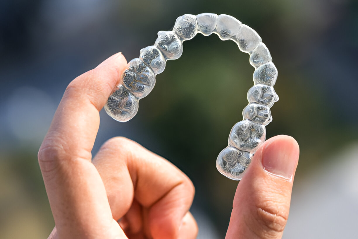 Everything You Need to Know About Invisalign Treatment at Heritage Dental in San Antonio, Texas_3