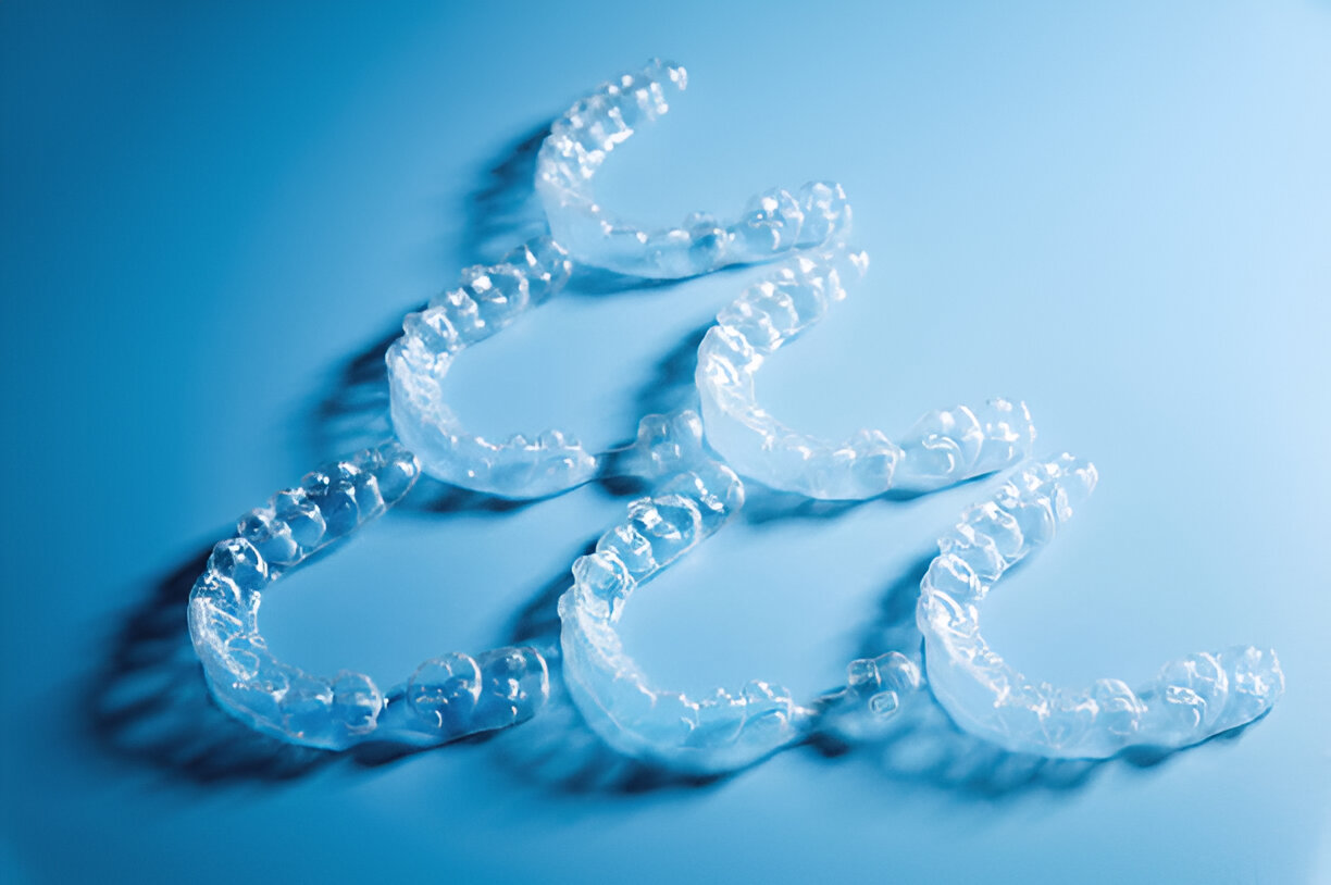 Everything You Need to Know About Invisalign Treatment at Heritage Dental in San Antonio, Texas_FI