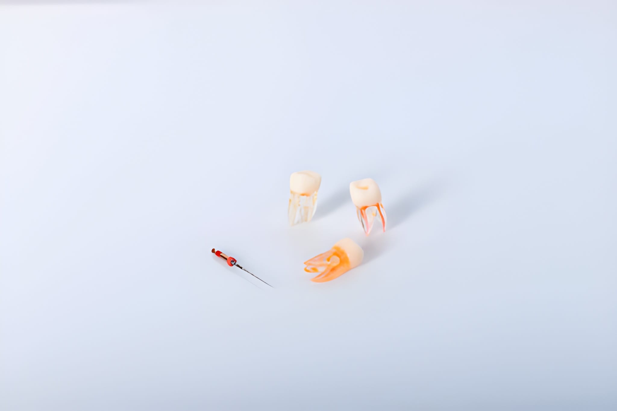 A Step-by-Step Guide to Root Canal Treatment at Heritage Family Dentistry_FI