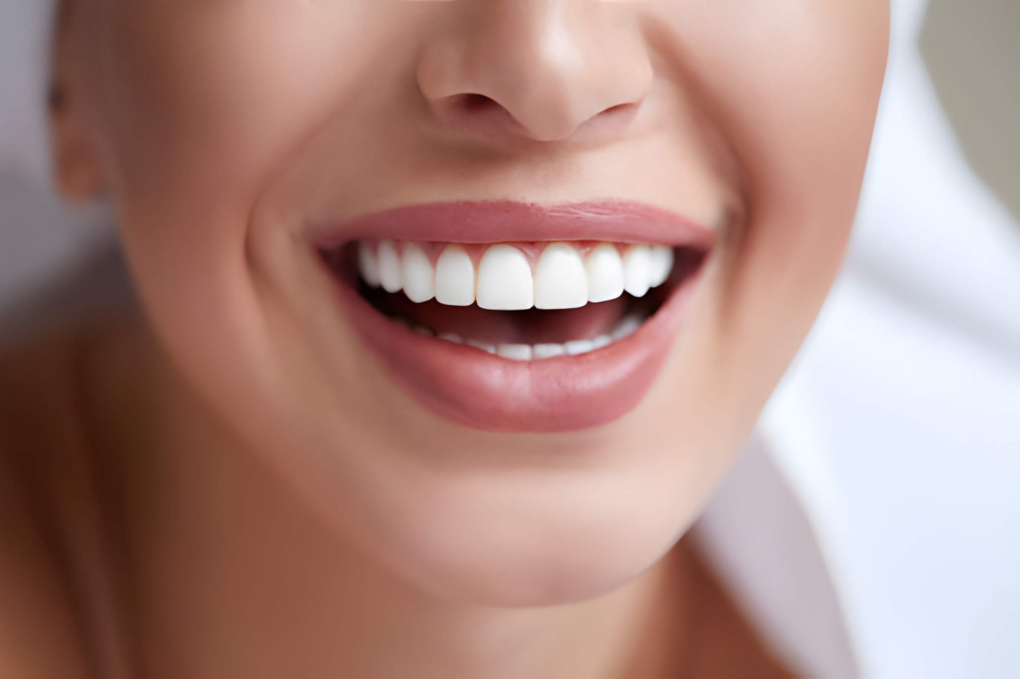 Is Professional Teeth Whitening Worth It? Advice from a San Antonio Dentist_FI