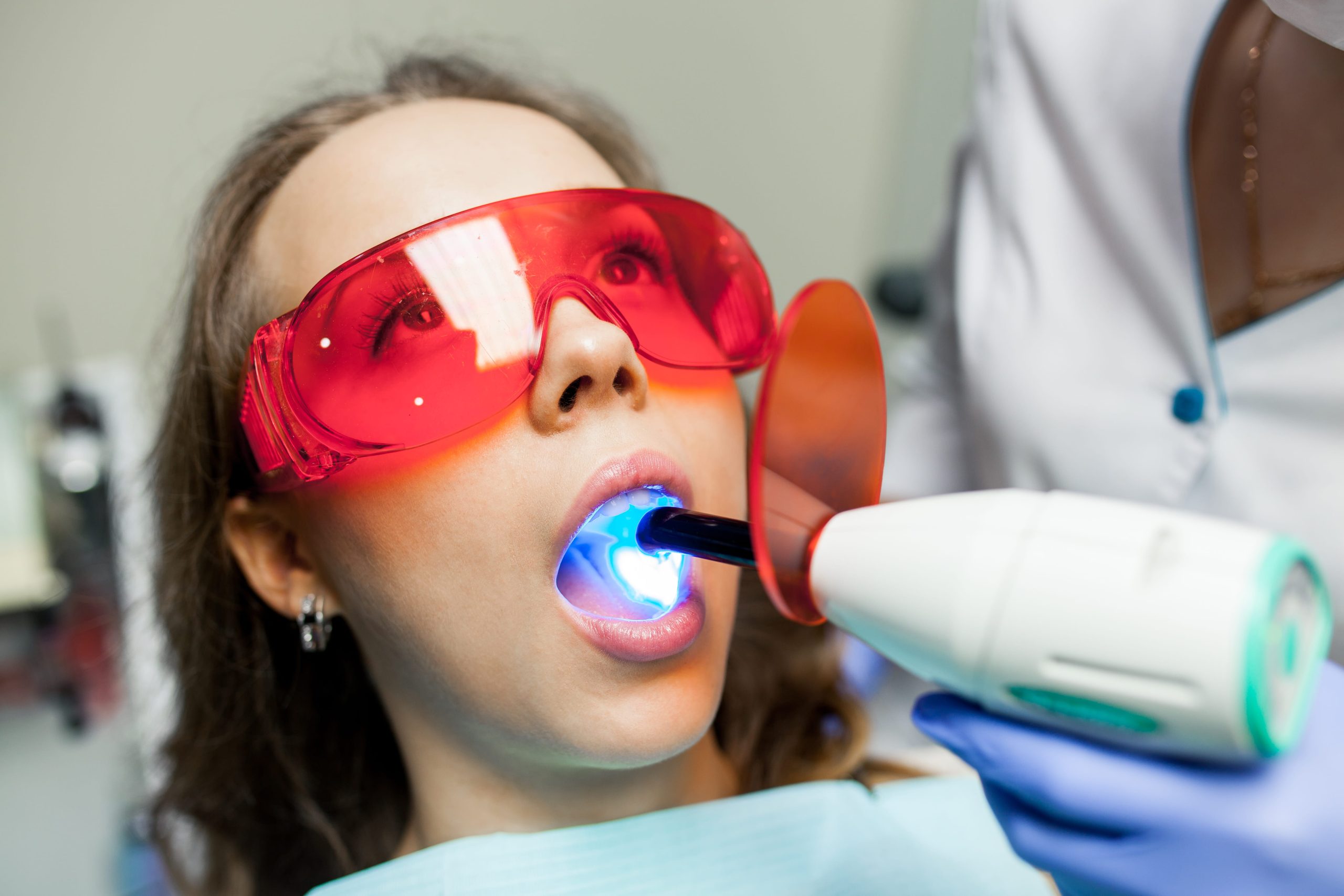 Before and after professional teeth whitening treatment by a dentist in San Antonio TX